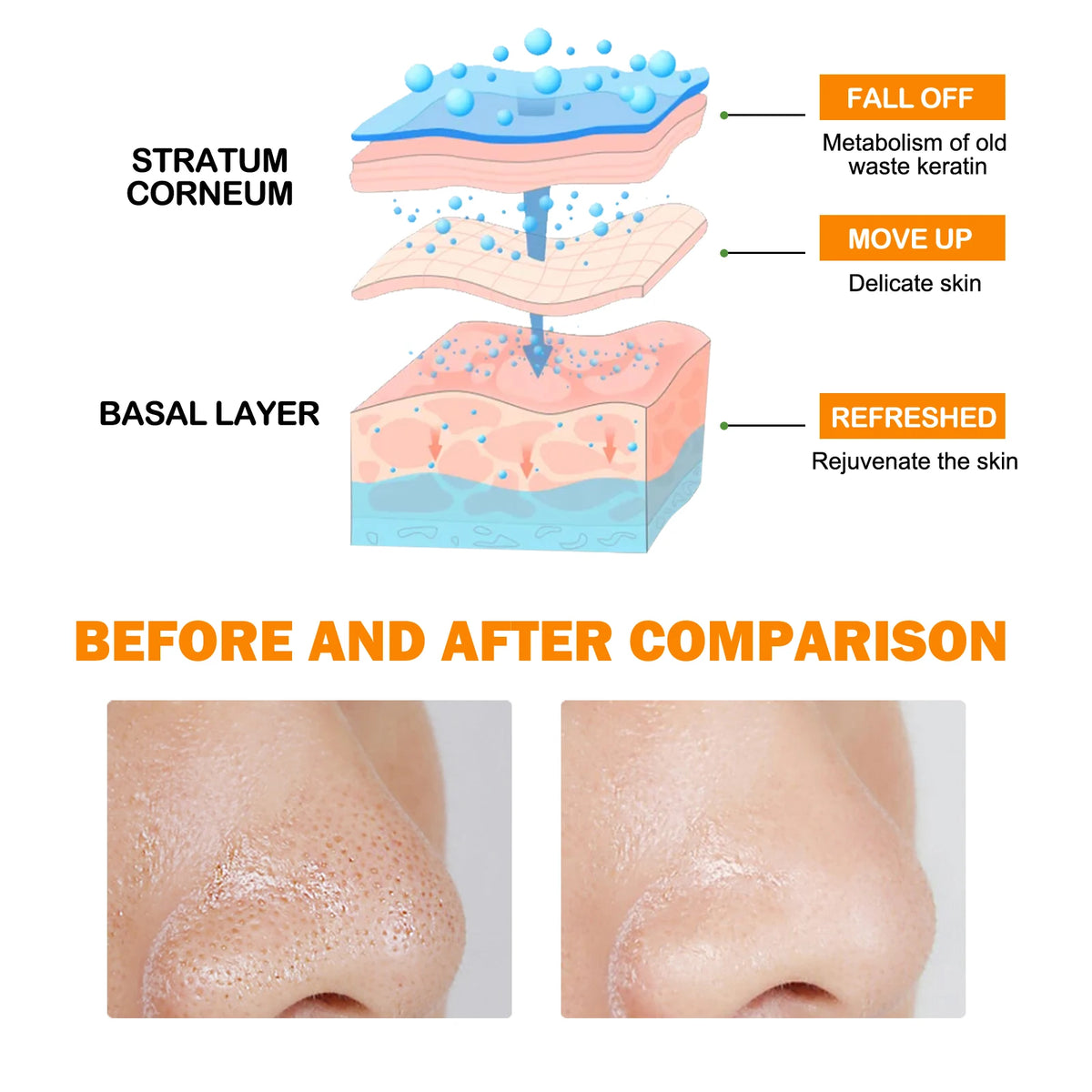 Blackhead Remover Gel With Niacinamide For Pore Cleansing And Smoothing
