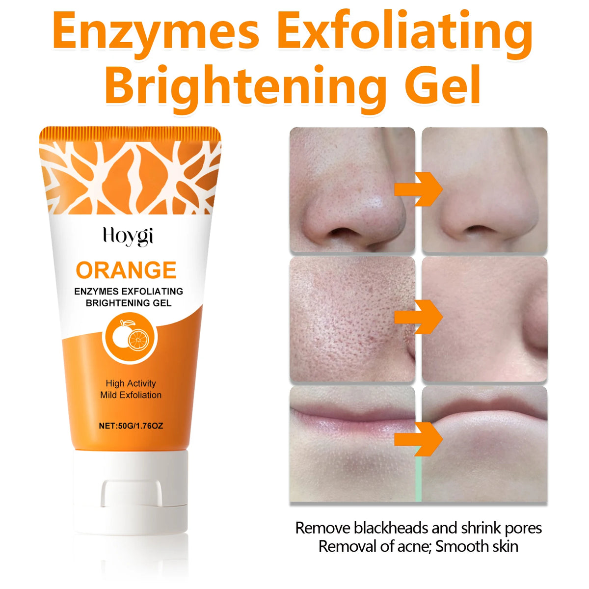 Blackhead Remover Gel With Niacinamide For Pore Cleansing And Smoothing