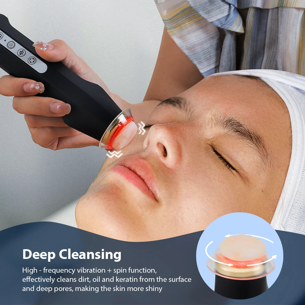 Foreverlily Oxygen Bubble Facial Pen For CO2 Skin Care Device